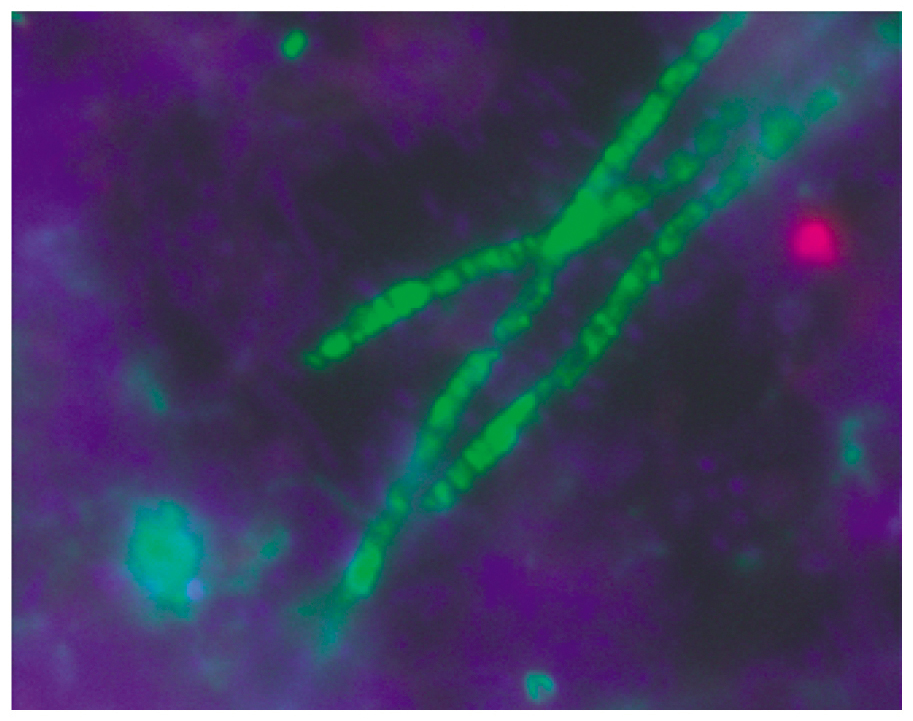Acidobacteria