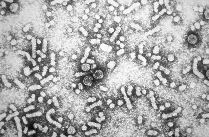 double-stranded DNA reverse transcriptase virus