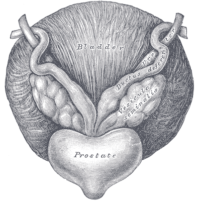 prostatectomy