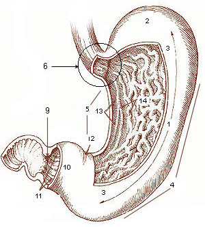 gastrectomy