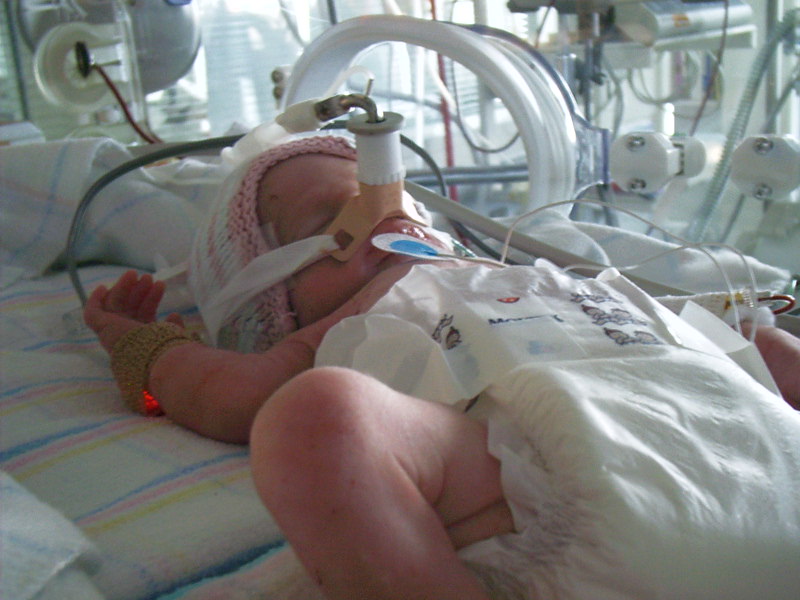 preterm infant
