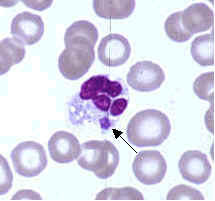 Ehrlichia