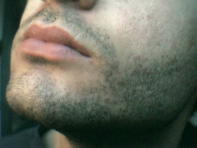 stubble