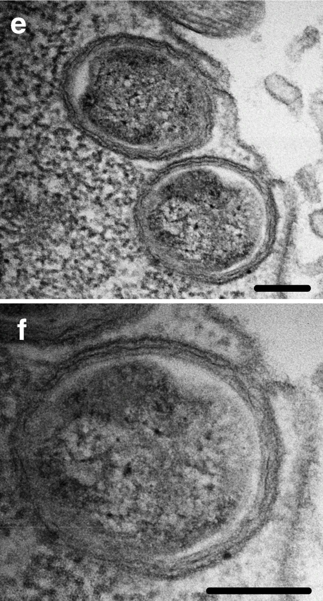 Desulfovibrio