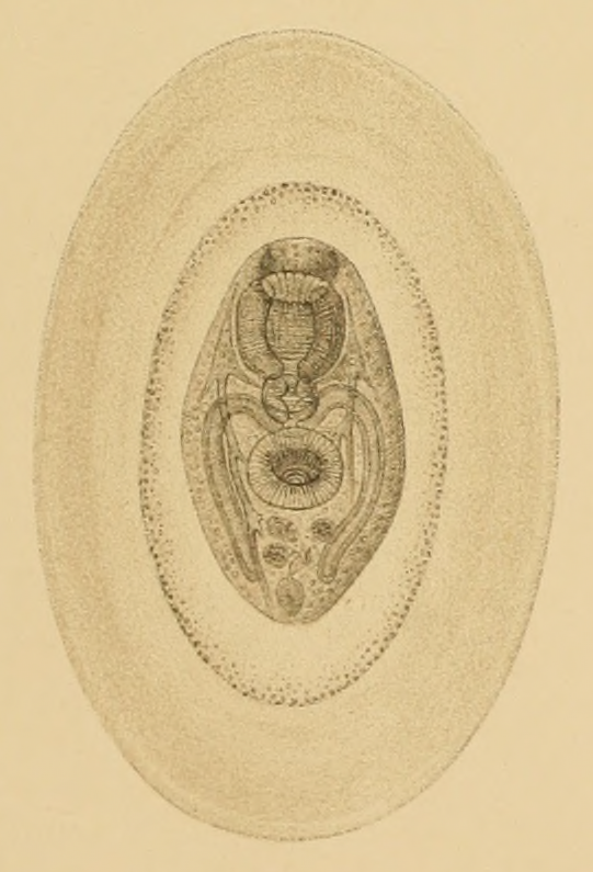 metacercaria