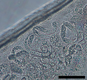 Dirofilaria repens