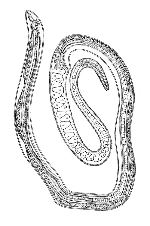 Trichocephalida