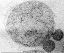 Nanoarchaeota