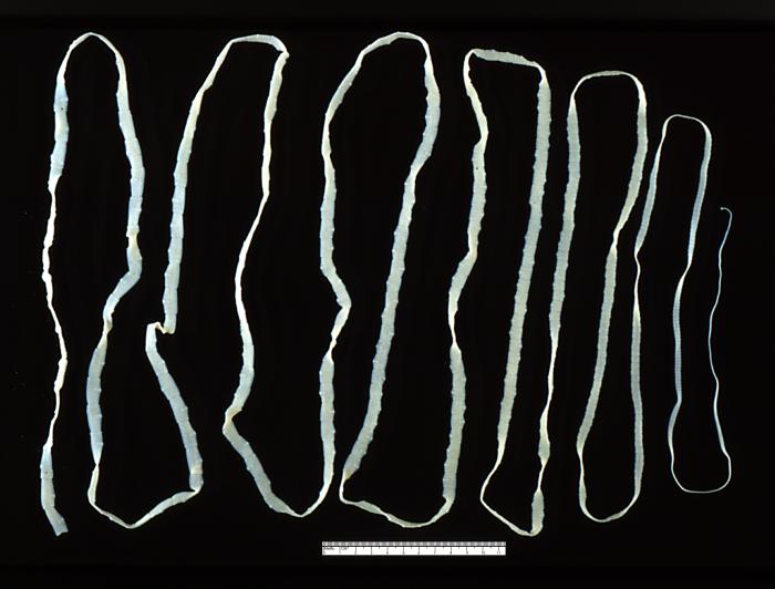 Cestoda