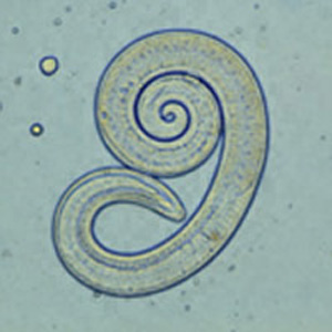 Trichinellidae