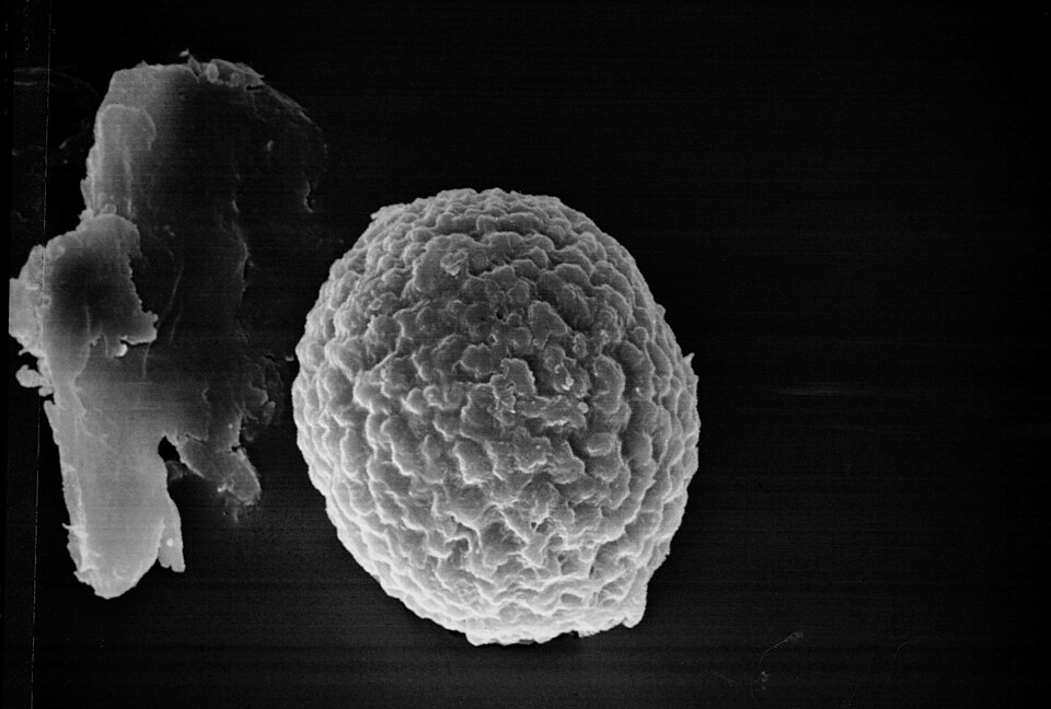 Tilletiaceae