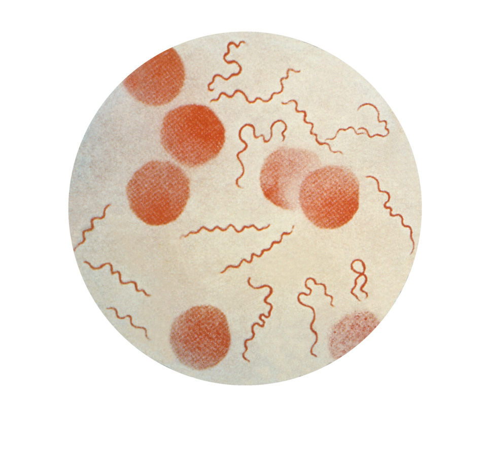Borrelia recurrentis
