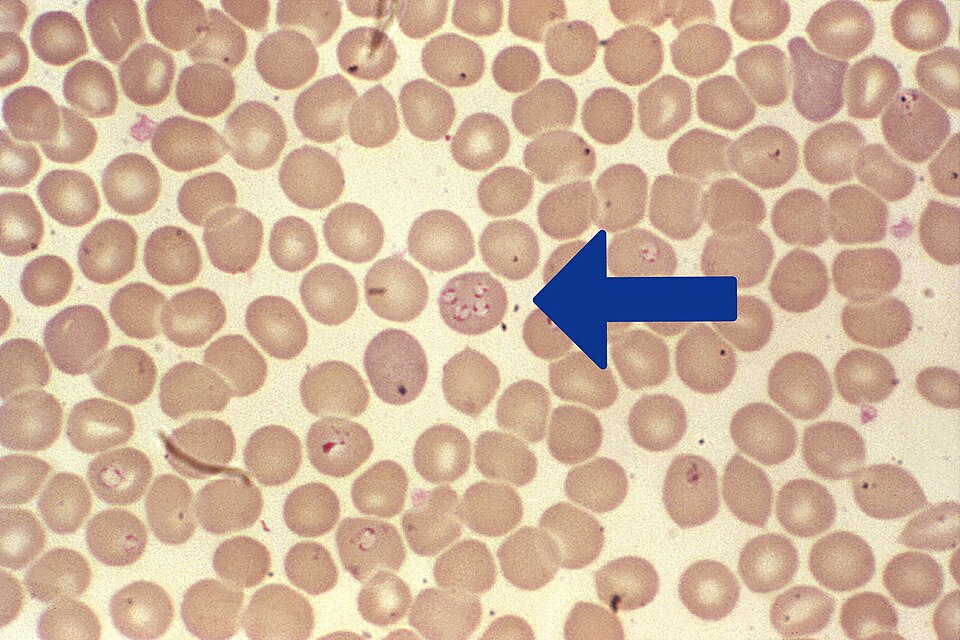 Piroplasmida