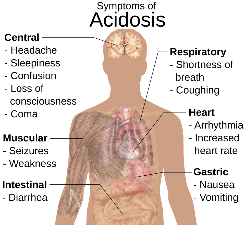 acidosis