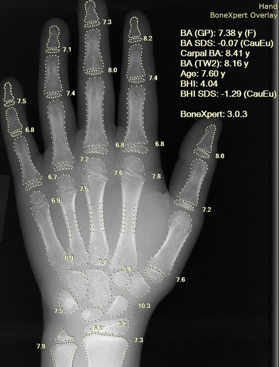 artificial intelligence in healthcare