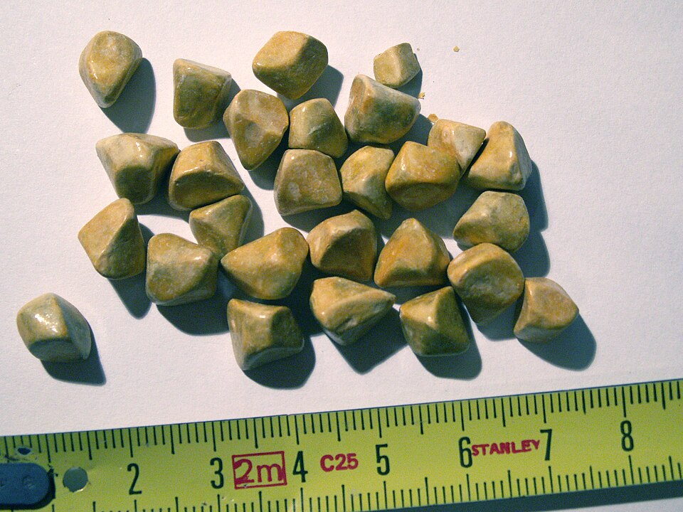 gallstone