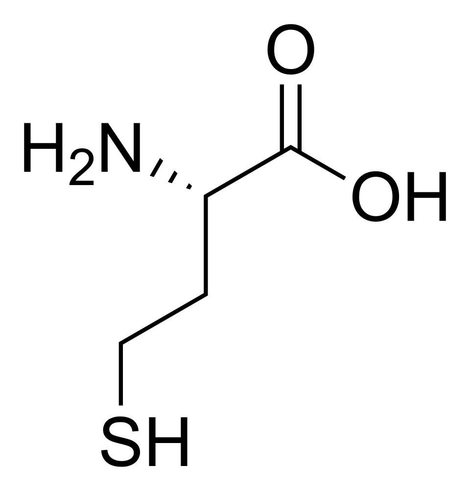 hyperhomocysteinemia